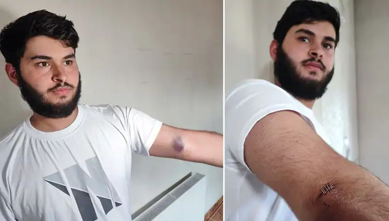 Topun Peşinde Koşturan Çocuklar Mahalleyi Karıştırdı: Conolar Kamyonetle Geldi